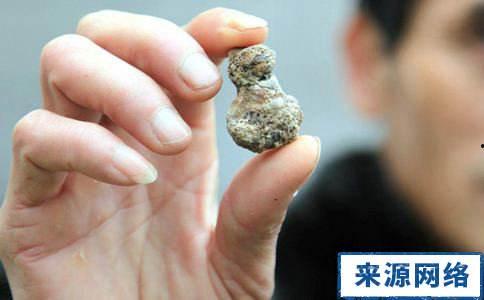 肾结石能吃黑瓜吗女性怎么吃,肾结石患者女性食用黑瓜的适宜方法与注意事项